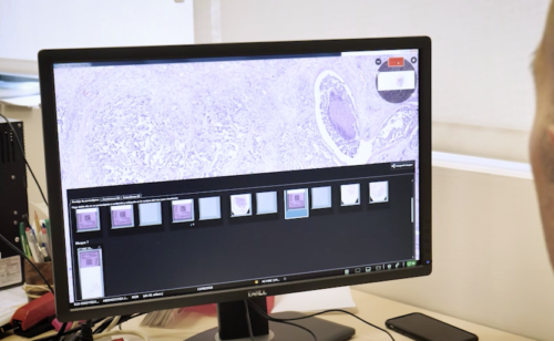 Patología digital: del microscopio al slide compartido online