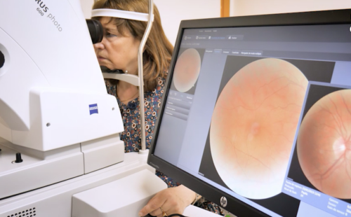 Diagnóstico precoz del edema macular diabético en atención primaria mediante retinografía asociada a tomografía de coherencia óptica