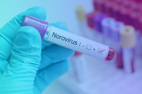 Chips de papel y smartphones: así es el innovador método para detectar el norovirus