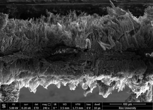 Filtros de grafeno: la nueva pequeña gran revolución contra las infecciones hospitalarias