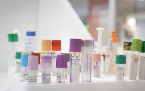 Cómo saber qué tubos de extracción de sangre y contenedores de recogida de muestras son los que indica la petición SAP