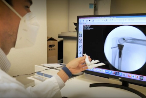 Impresión 3D como apoyo a la cirugía ortopédica